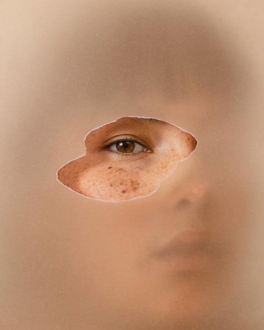 Signs of damaged skin barrier.